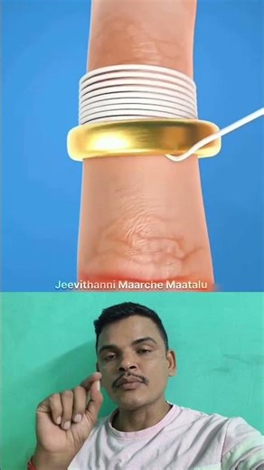 Easy Way to Remove a STUCK Ring from Your Finger! #RingRemoval #LifeHacks #FingerCare #SmartTips