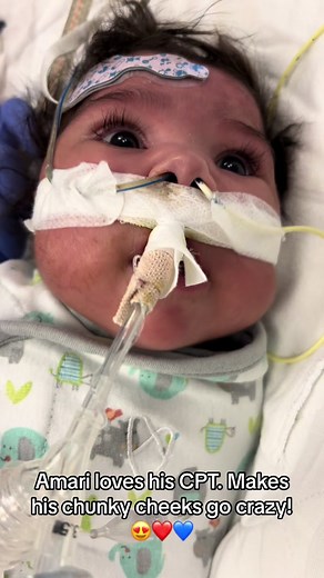 CPT Respiratory Therapy for Amari - Heart Warrior Story