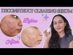 Deconstruct Clearing Serum | Serum for Acne Marks | #skincare #acneproneskin