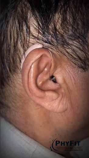 Connect Signia Hearing Aids with Android Mobile via Bluetooth || Signia Pure Charge and Go AX RIC