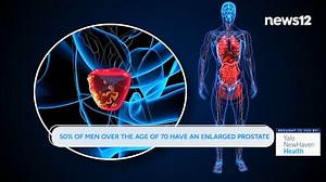 2.6K views | be Well: Procedure to treat enlarged prostate. It boasts a fast recovery and no hospital stay. In today's health check, we speak to a doctor from Greenwich Hospital about a minimally invasive surgical procedure to treat an enlarged prostate - https://bit.ly/4jHJroq | News 12 Connecticut | Facebook