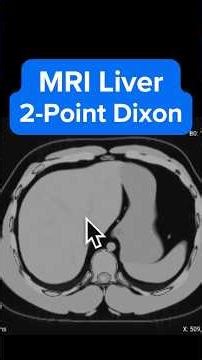 MRI 2-Point Dixon Technique Explained in 3 min