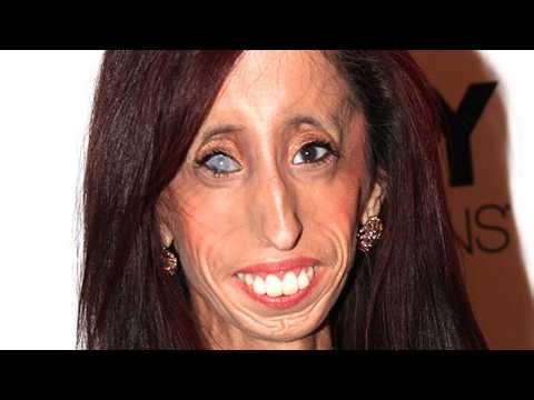 Do You Remember Her? Take A Deep Breath Before Looking At Her Now | Lizzie