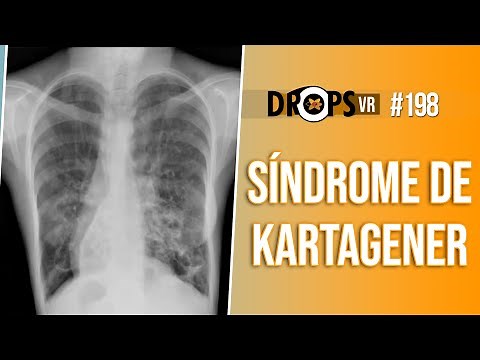 Imaging findings of Kartagener syndrome