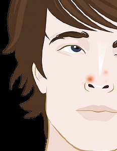 How to get rid of spots on the nose | The ultimate guide »