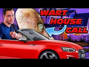 First Ever House Call Plantar Wart!