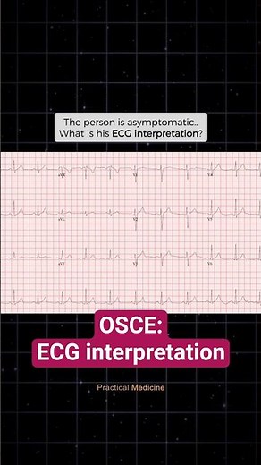 [OSCE: ECG] Doctor, Interpret this ECG for me, please?