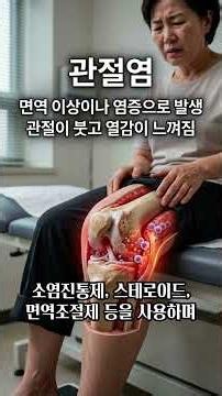 관절염과 관절증, 같은 병이 아닙니다! 무릎 통증의 진실! 관절염 vs 관절증새창으로 읽기