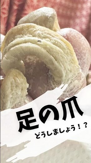 【伸び過ぎた足の爪どうしましょう？】仙台訪問出張足の爪切り