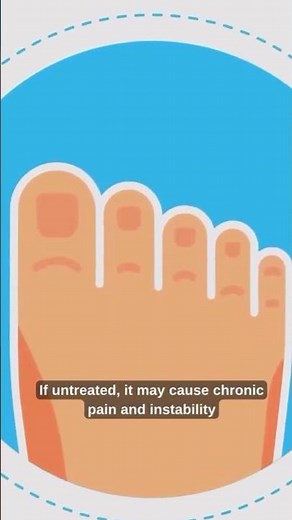 👉 Turf Toe Explained: Why It’s More Than “Just a Sprain” | Naples Podiatrist