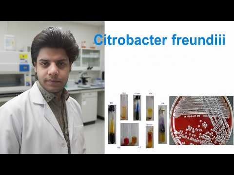 Citrobacter Freundii Bacteria: discovery: types: culture media: biochemical test etc