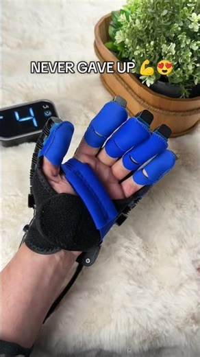 Your Hand Won’t Move After Stroke? Watch This