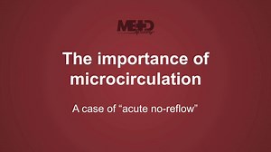 1K views | Today’s video is an impressive case-demonstration of the acute no-reflow phenomenon. After watching this video, you’ll understand why the coronary microcirculation is so important. Find out more here: https://bit.ly/3l5EdEM | Medmastery | Facebook