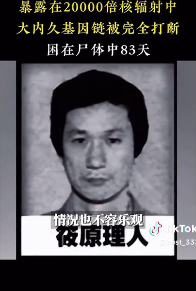困在尸体中的83天：暴露在20000倍核辐射中，基因链被完全打断#大内久#人物故事#真实事件#历史#核泄漏#核辐射#人生百态