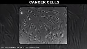 3.5K views · 71 reactions | Here's what cancer cells look like in contrast to healthy cells. | Reactions | Facebook