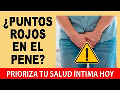 Puntos Rojos En El Glande 💥 Soluciones Efectivas: Guía Práctica Sobre La Balanitis