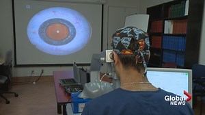 High-tech simulator gives future eye surgeons in Calgary “real life” training