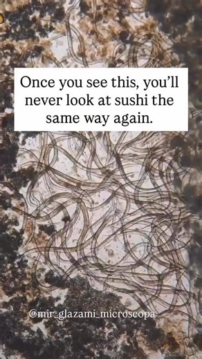 SALMON: EVERY SQUARE INCH HAS 10,000 WORMS & 100,000 WORM EGGS🪱🫣 IF YOU EAT SALMON DO A PARASITE DETOX Salmon has tapeworms to roundworms, these critters can lay thousands of eggs in just one piece of salmon! 🥚🥚 But don’t worry, there’s a solution! 🌿 Detoxing parasites is essential to keep your body healthy and thriving with our heavy metals binders you remove their food source ( Heavy metals ) so even if you eat them , your body is so clean they want to leave ! Then we use our para shield 