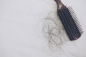 11 principais causas da queda de cabelo (e o que fazer).