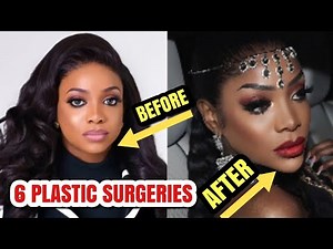Chioma Good Hair Before And After Plastic Surgery | Chioma plastic Dull