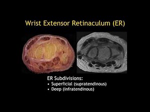 Flexor and Extensor Tendons of the Wrist by Brady Huang, M.D.