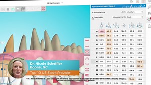 Spark™ Clear Aligner System, Release 11 is here, featuring primary upgrades including: ✅ Mixed dentition support ✅ Anatomical beveled attachments ✅ Redesigned Bite Ramps ✅ Downloadable STL Files. Learn more and request information for your practice today. | Ormco