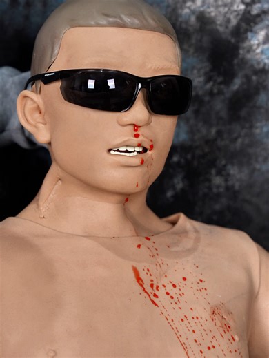 🩸 NOSEBLEED 101: Don't tilt your head back! ❌ Common mistake: Leaning back can cause blood to flow down your throat, leading to choking or nausea. ✅ DO THIS INSTEAD: Lean FORWARD slightly Pinch the soft part of your nose for 10-15 mins Apply ice pack to the BACK OF YOUR NECK to constrict blood vessels Breathe through your mouth This simple technique helps stop bleeding faster and keeps airways clear. Save this for emergencies! 💙 #FirstAid #NosebleedTips #HealthTips #SafetyFirst #FirstAidKit #E