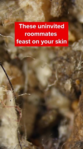 Understanding Dust Mites: Arachnids, Not Insects