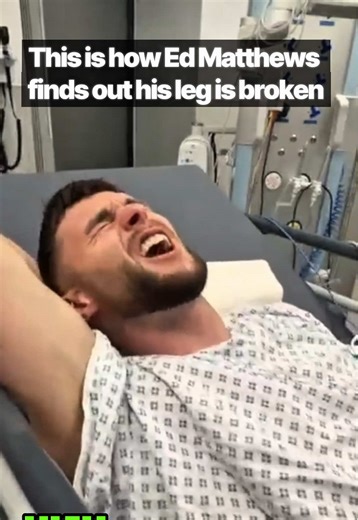 Understanding Recovery After a Broken Leg