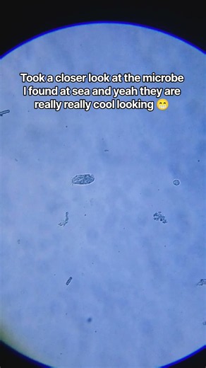 Microorganisms under the microscope 🔬