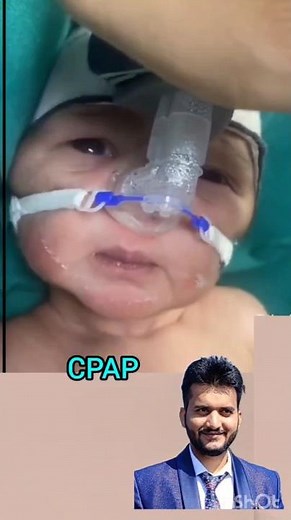 Cpap #neonatal cpap #Respiratory distress syndrome #Prematurity apnea