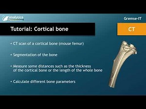 Tutorial video (CT): "Cortical bone"