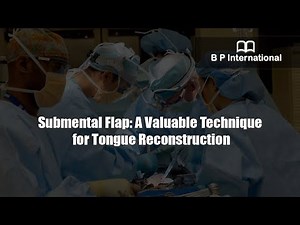 Submental Flap: A Valuable Technique for Tongue Reconstruction