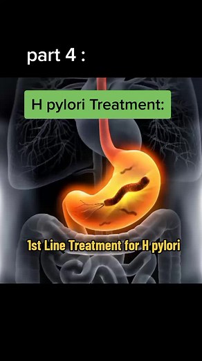 Effective H pylori Treatment Options: Detailed Overview