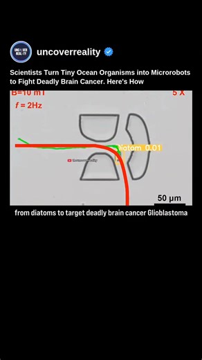 Scientists Turn Tiny Ocean Organisms into Microrobots to Fight Deadly Brain Cancer #robot #shorts