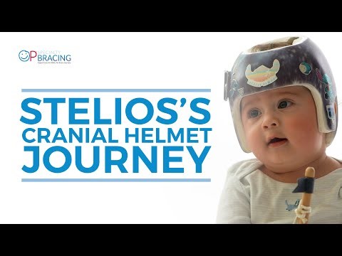 Stelios's Cranial Helmet Journey