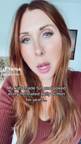 Outie to an innie just like that! #postsurgery #recovery #healing #mommymakeover