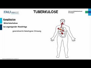 Pathologie ─ Tuberkulose