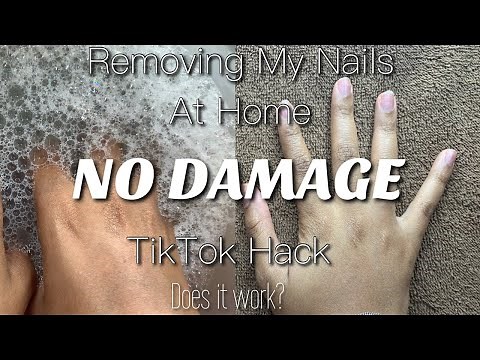 Watch Me Remove My Nails at Home | TikTok Nail Hack
