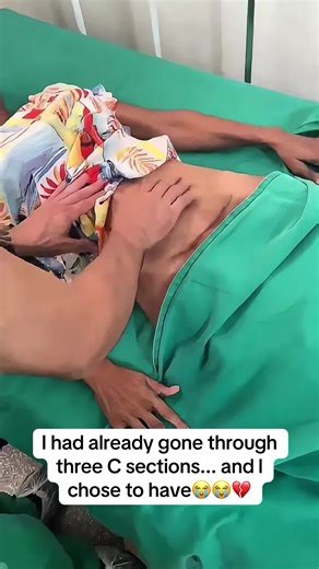 Challenging C-Section Journey: A Candid Experience