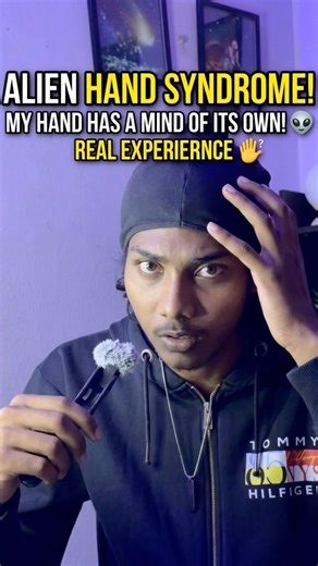 The alien hand syndrome #shorts #telugushorts #telugufacts #telugu