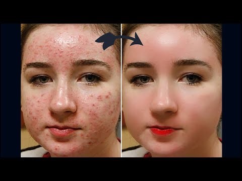 NSDA Level 3 | Retouching Magic Transform Your Photos