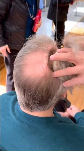 Life-Changing Cranial Prosthesis: Frank’s Incredible Recovery! 🧠✨