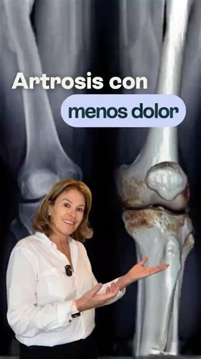 Osteoarthritis with less pain