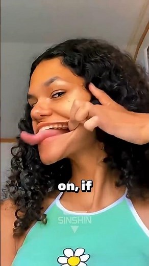 What Happens If You Lose Your Tongue? 😳👅#shorts #viral #viralvideo #treending #viralvideo