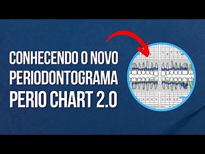 Periodontal Chart online 2.0: o que mudou?