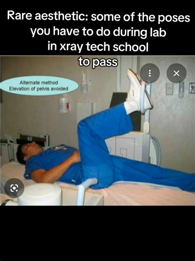 like how did they even discover some of these #fyp #radtechstudent #xrayschool #rareaesthetic #radiology