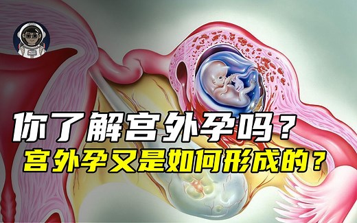 一分钟带你了解宫外孕是如何产生的