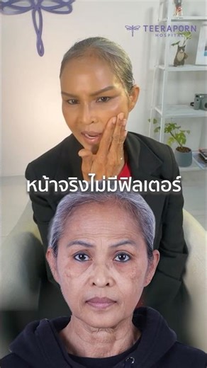 จับหน้าให้ดูกันสดๆ ไม่ต้องกลัวฟิลเตอร์หลุด โรงพยาบาลธีรพร หมอชลธิศ