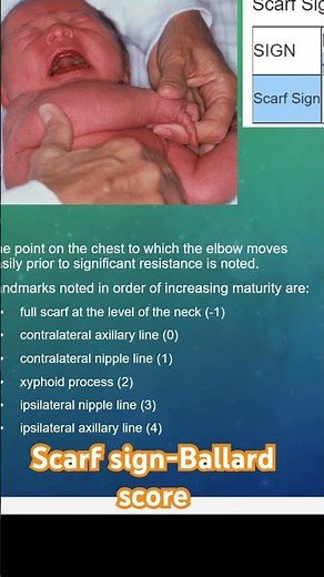 Scarf sign-Ballard score
